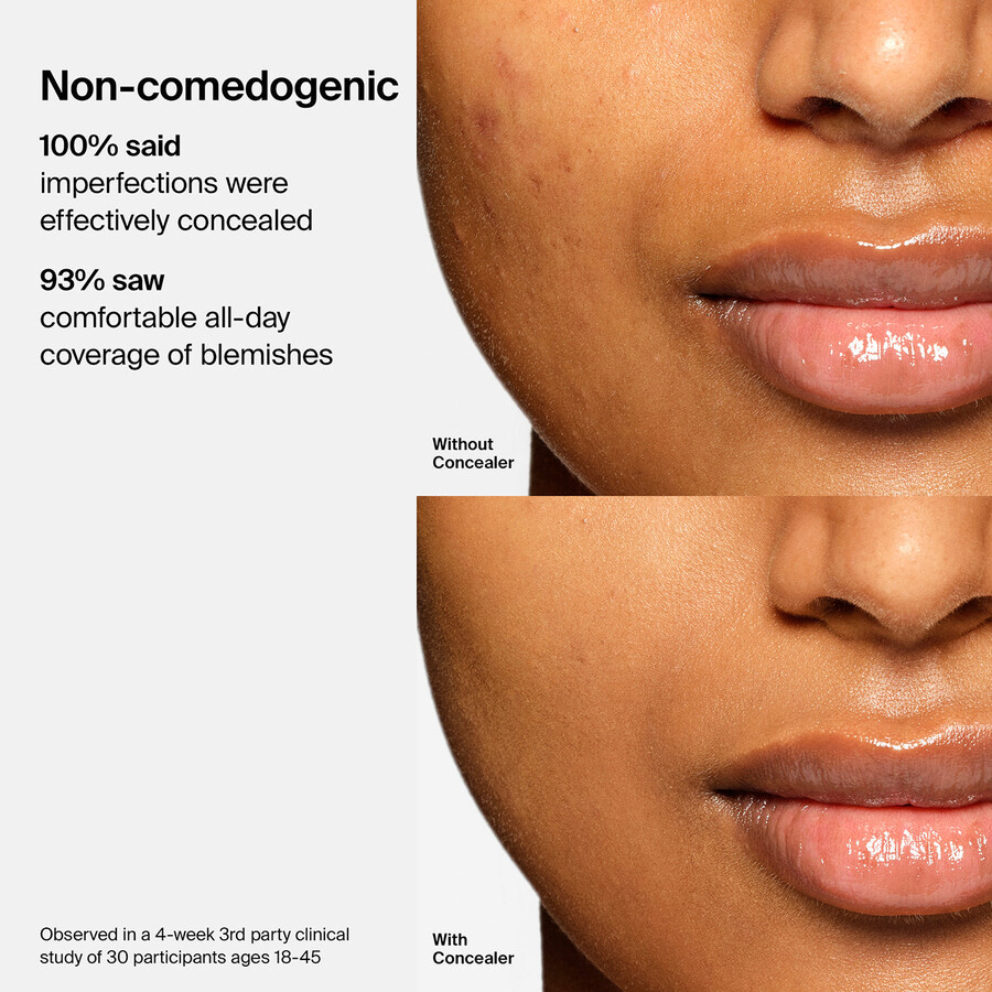 corrector triclone skin tech